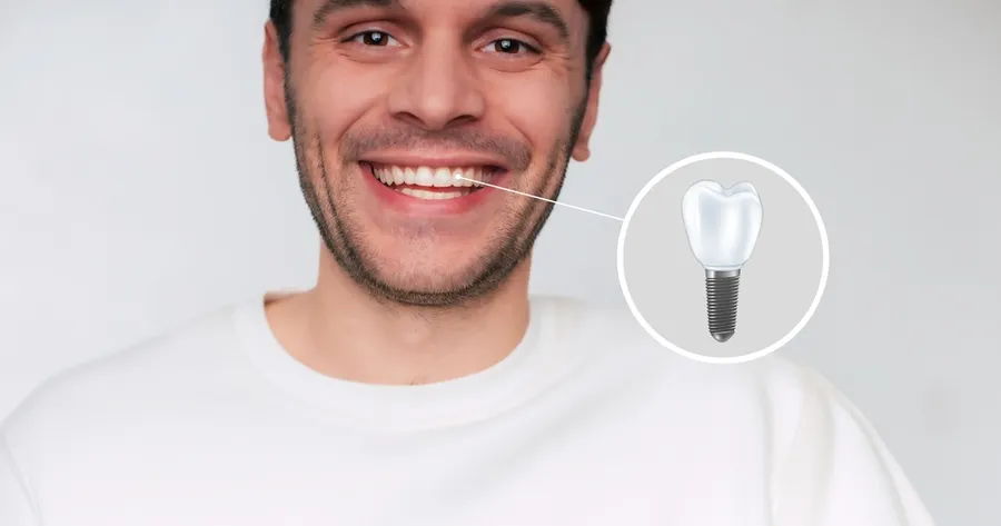 Affordable Dental Implants: Cost Saving Options And Clinical Trials