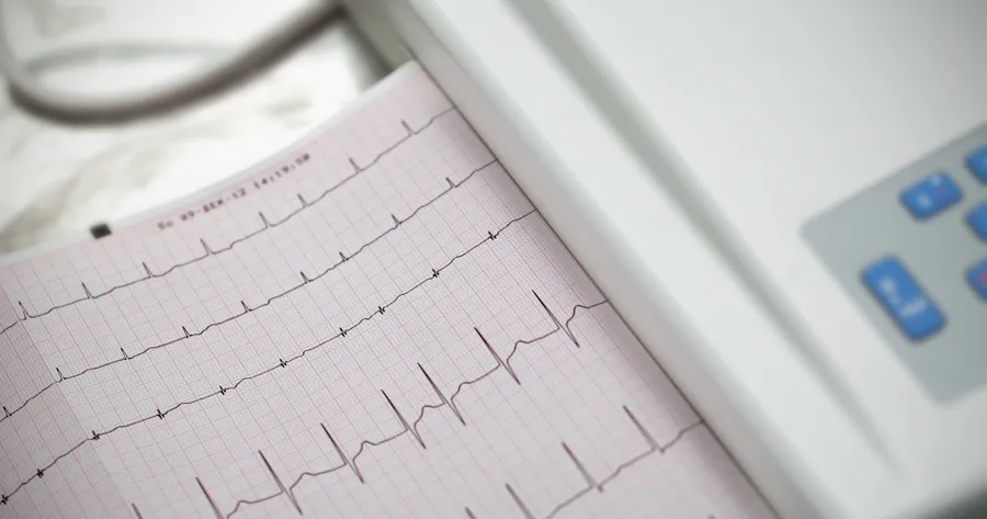 Understanding Atrial Fibrillation: Symptoms, Risks, and Management