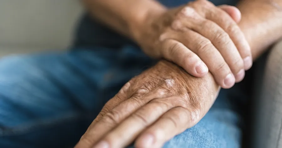 Most People Overlook These Common Psoriatic Arthritis Signs and Symptoms