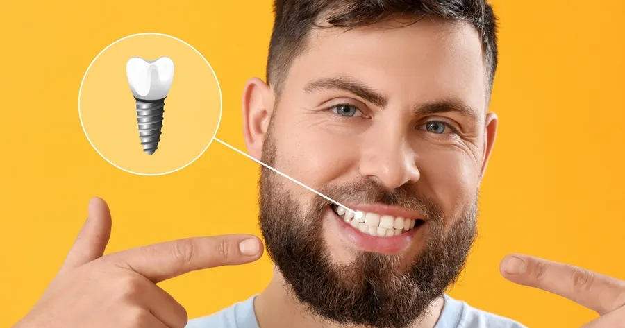 How To Find Dental Implants Near You: Choosing the Right Dentist