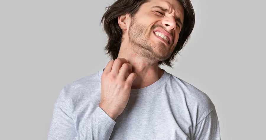 Common Signs of Atopic Dermatitis and Available Treatment Options