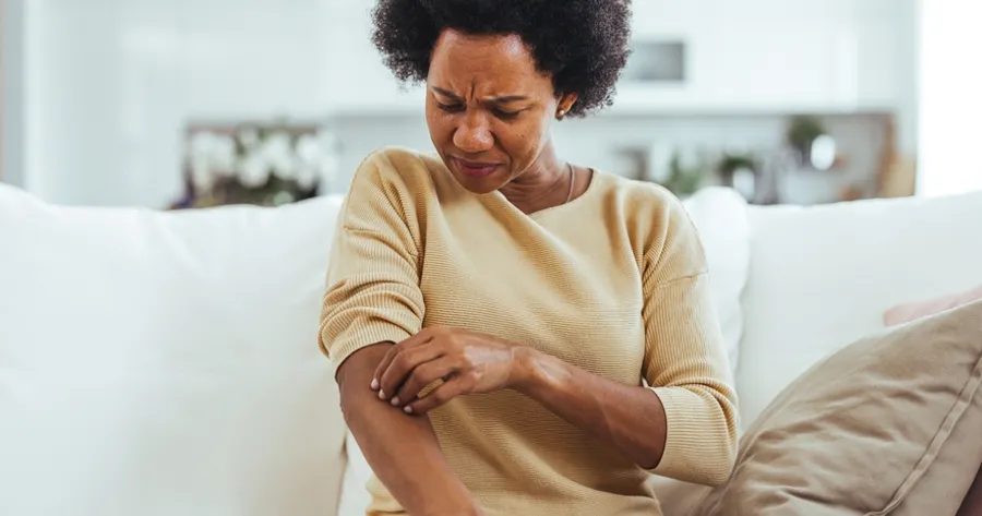 Identifying Plaque Psoriasis Symptoms