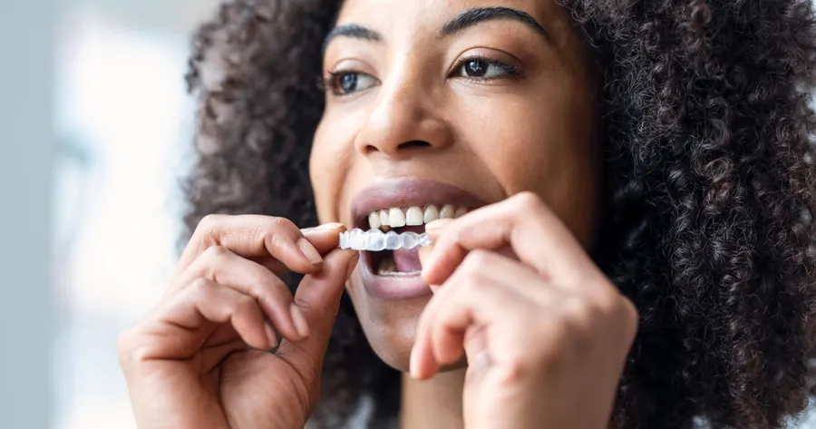 Invisalign – A Discreet, Comfortable, Proven Teeth Alignment Solution