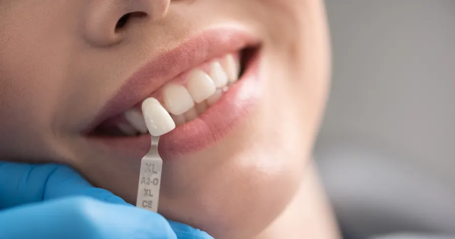 Uncover Affordable Dental Implants: Specials and Deals Await