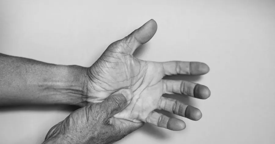 Understanding Peripheral Neuropathy: Causes, Symptoms, and Treatment Options