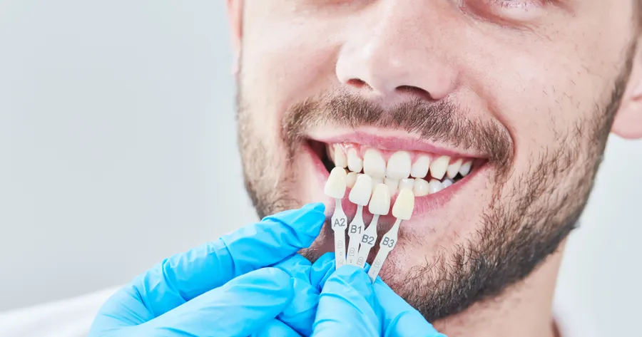 Who Is Eligible For Dental Implants?
