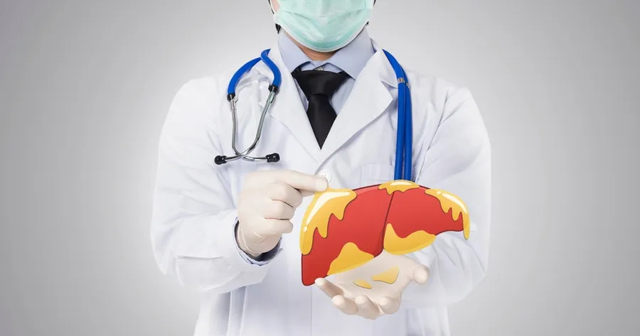 Medications That May Cause Fatty Liver Disease