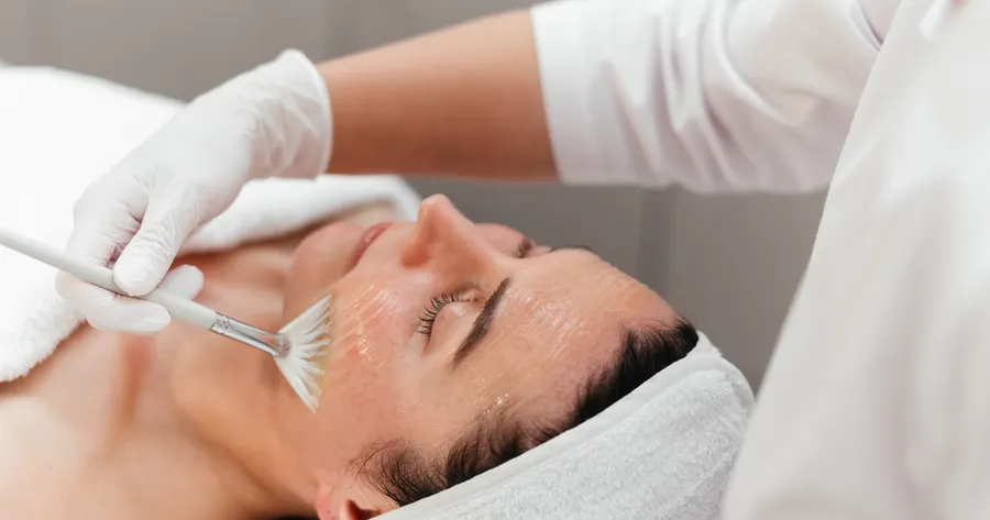 At-Home Peels: How Do They Compare With Professional Treatments?