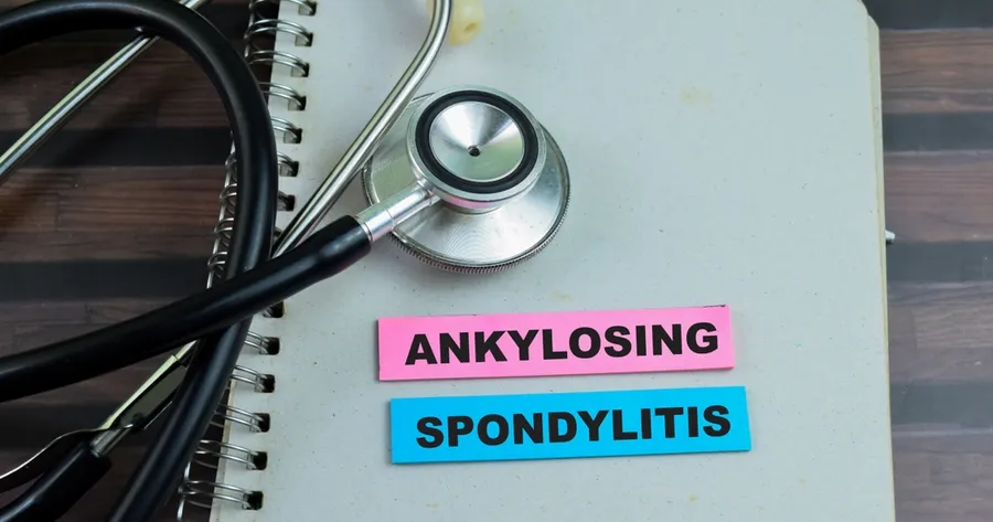 Living With Ankylosing Spondylitis Managing Pain And Improving Mobility