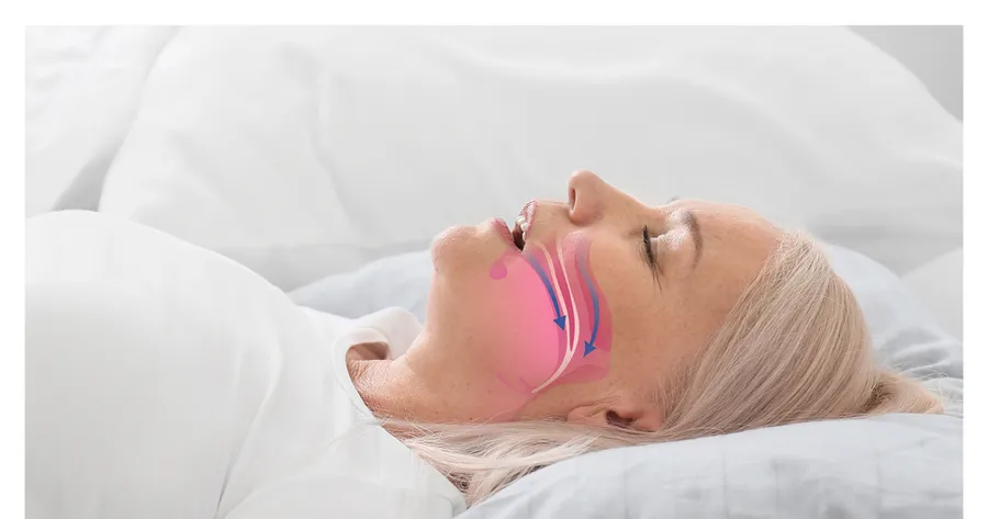 How Anti-Snoring Devices May Improve Sleep Quality