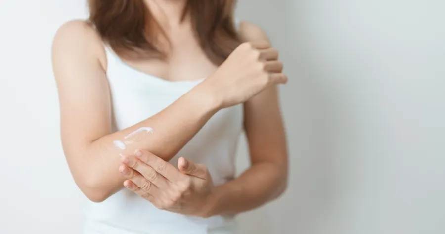 Exploring Affordable Treatment Options for Managing Eczema Symptoms