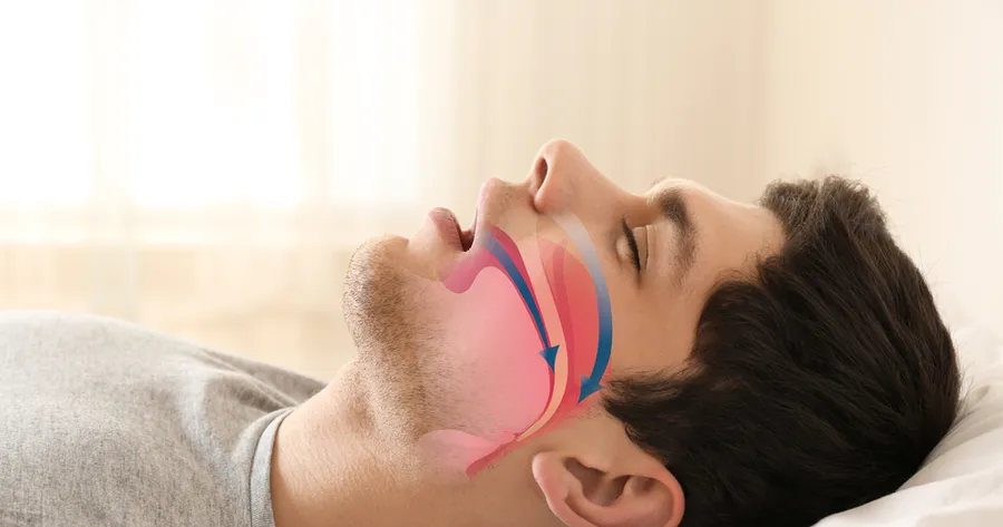 How Sleep Apnea Studies Benefit Participants