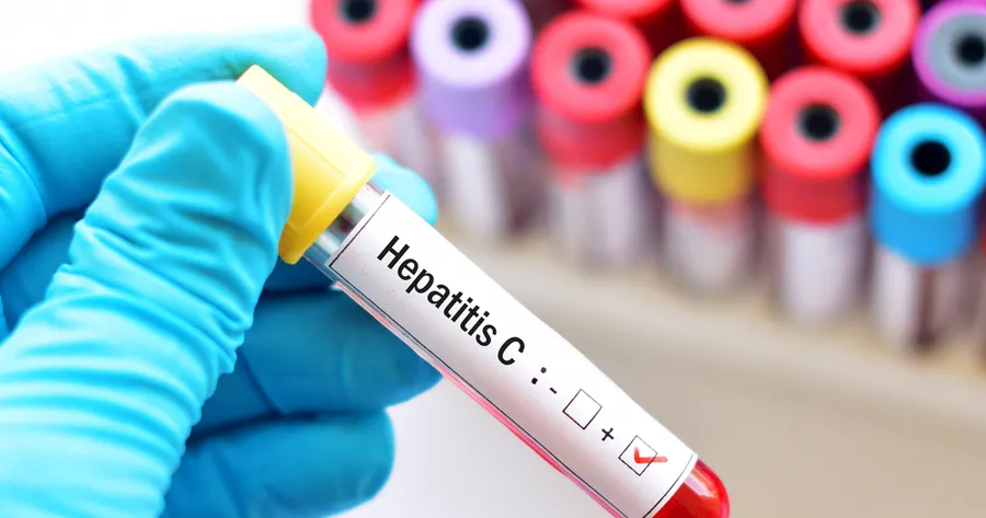 Symptoms of Hepatitis C You Might Be Ignoring: What Doctors Don’t Tell You