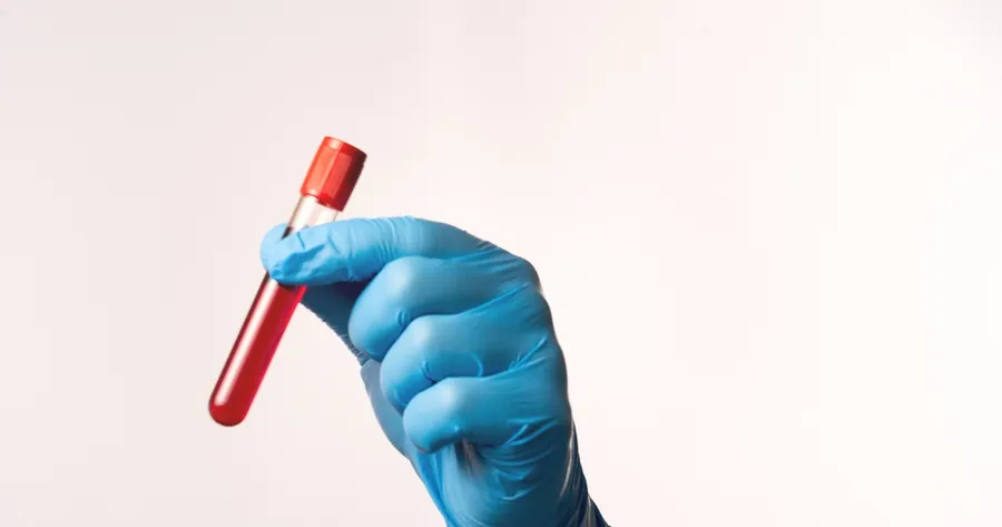 Understanding the Importance of the Early Detection of HIV