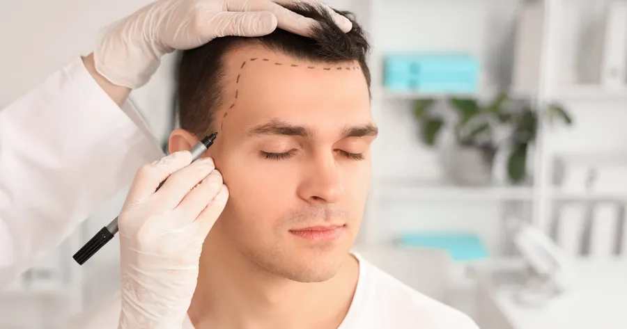 Explore Hair Transplant Options and Benefits