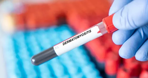 Understanding Dermatomyositis: Symptoms, Causes, and Treatment Options