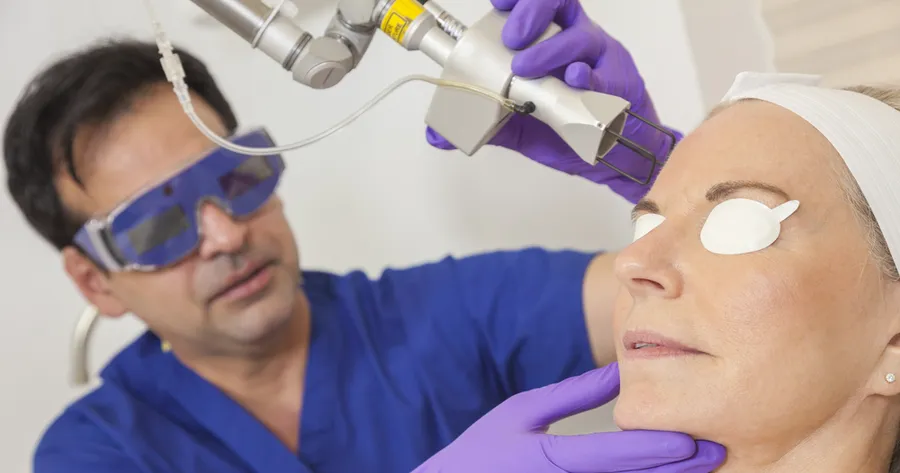 Types of Facial Laser Treatments Explained