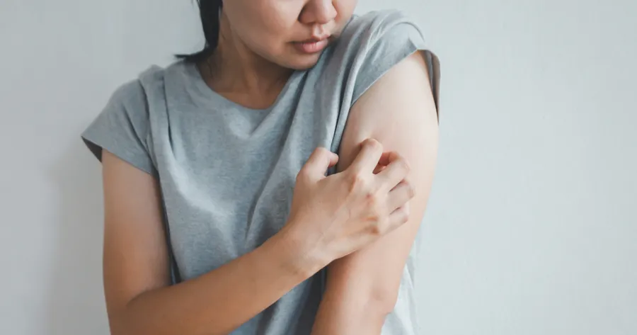 Atopic Dermatitis: Key Triggers and Prevention Tips