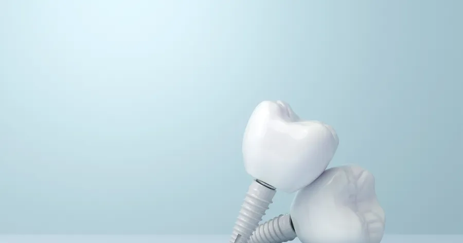 Making Dental Implants Affordable and Rewarding